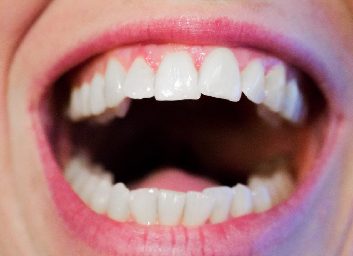 Nowoczesna technika stosowana w salonach stomatologii estetycznej może sprawić, że odbierzemy prześliczny uśmiech.